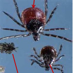 First probable case of new tick-borne illness identified in region